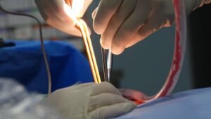smart fixes for frequent routine complications